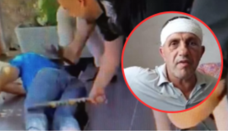 U ankuan se gurëthyesit po ua shkatërrojnë shtëpitë, vëllezërit dhe djali i deputetit të PS-së rrahin për vdekje qytetarin